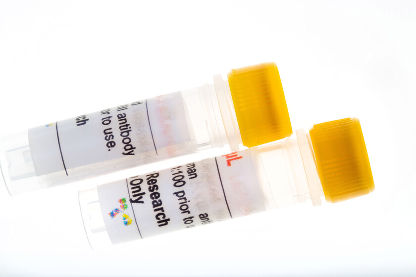 &alpha;1-Antitrypsin EIA