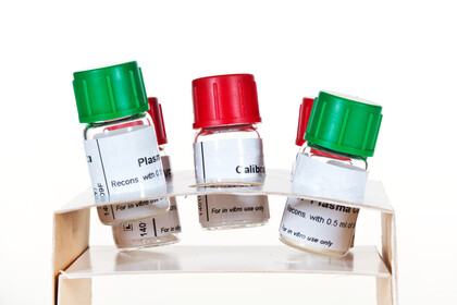 Bivalirudin (Angiox®) Plasma Control